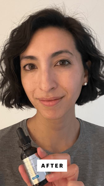 Pai after applying SkinCeuticals PTiox serum to her face